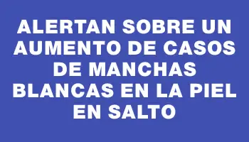 Alertan sobre un aumento de casos de manchas blancas en la piel en Salto