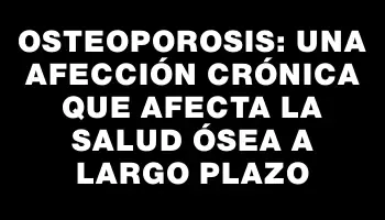 Osteoporosis: una afección crónica que afecta la salud ósea a largo plazo