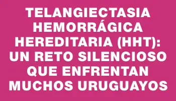 Telangiectasia Hemorrágica Hereditaria (hht): un reto silencioso que enfrentan muchos uruguayos