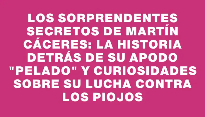 Los sorprendentes secretos de Martín Cáceres: la historia detrás de su apodo "pelado" y curiosidades sobre su lucha contra los piojos